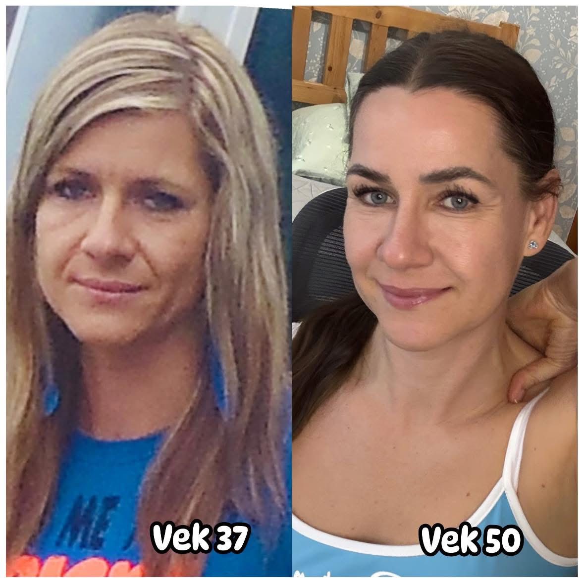 Porovnanie dvoch fotografií ženy vo veku 37 a 50 rokov, ukazujúce zmenu vzhľadu.